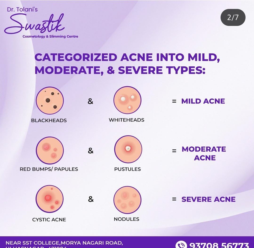 # Chemical Peel Service in Diva
# Hair PRP Service... main image