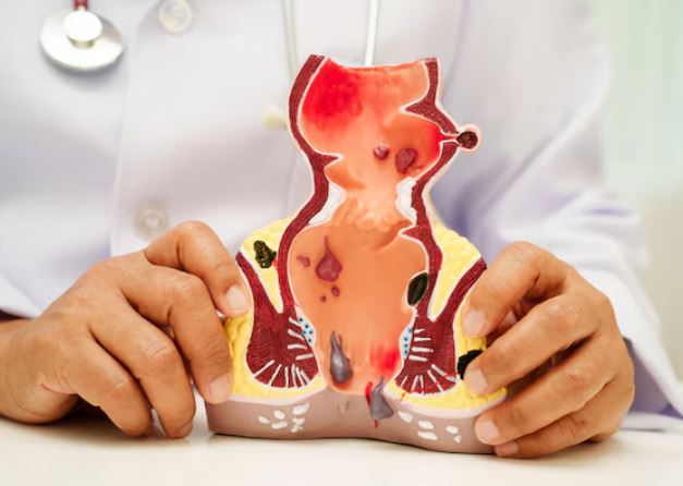 Proctologist in Mumbai Anorectal conditions suc... main image