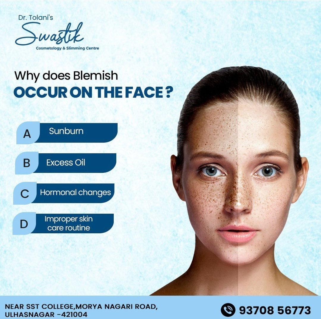 # Blemish free Skin in Ambernath 
# Acne Free Skin... main image