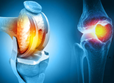 Best Orthopedic Surgery in Chennai KC Hospital ... main image