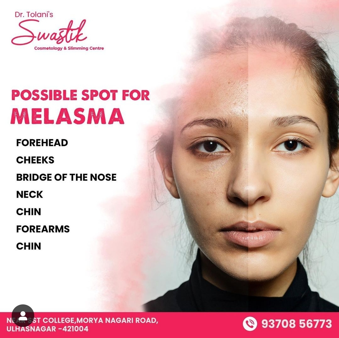# Blemish free Skin in Ambernath 
# Acne Free S... main image