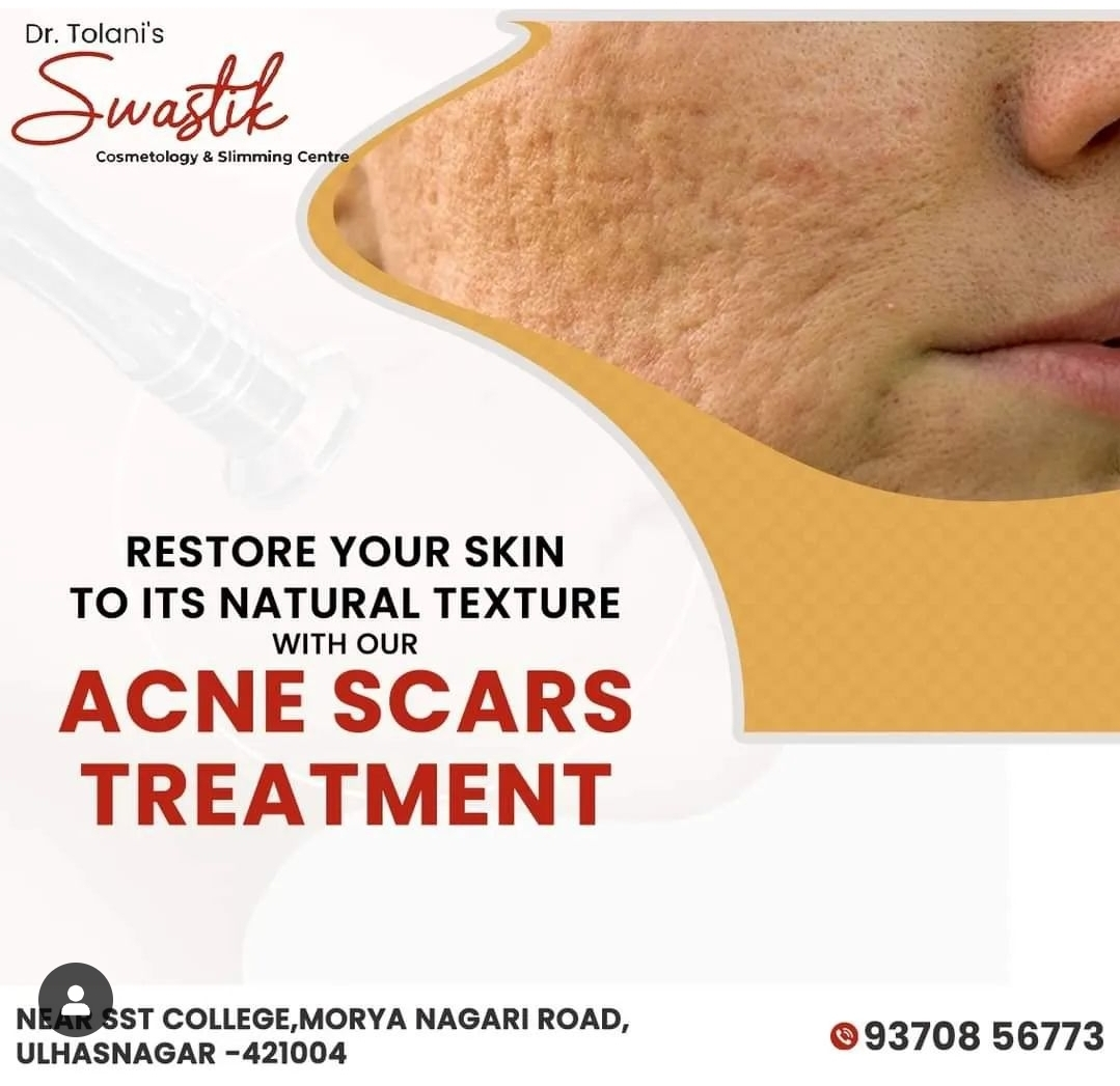 # Blemish free Skin in Thakurli
# Acne Free Skin i... main image