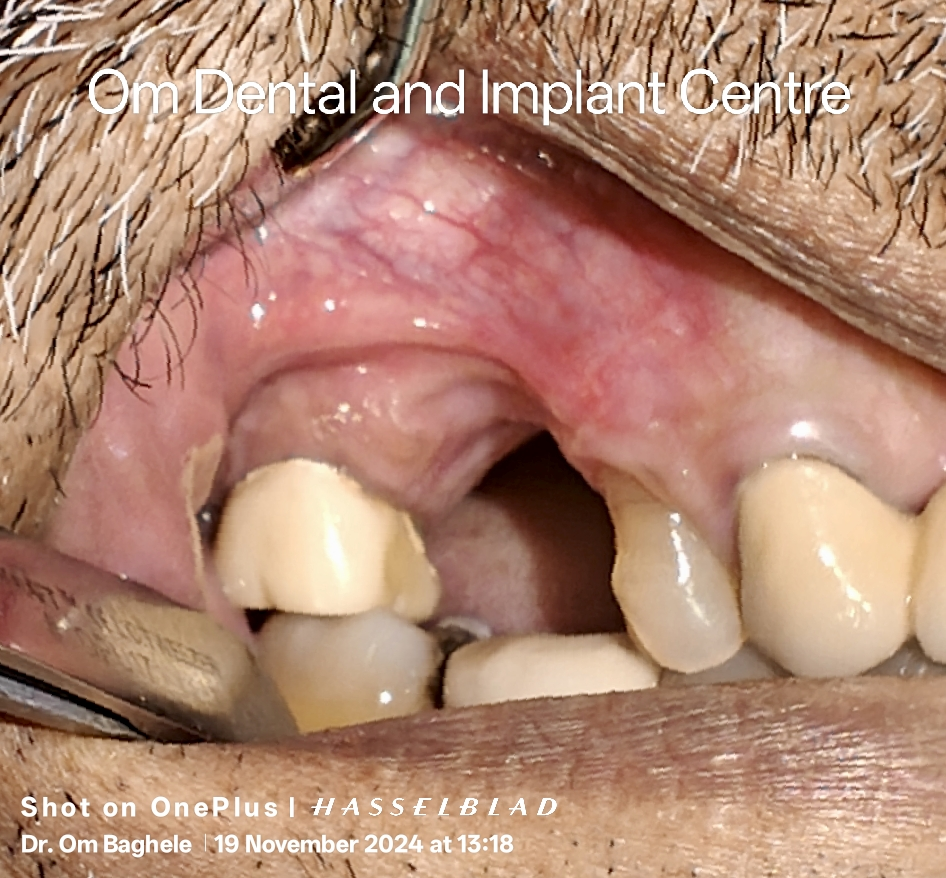 Complex Situations in Implant Dentistry 
The si... main image