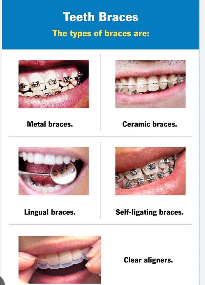🦷 Ready for a Smile Transformation? Discover th... main image