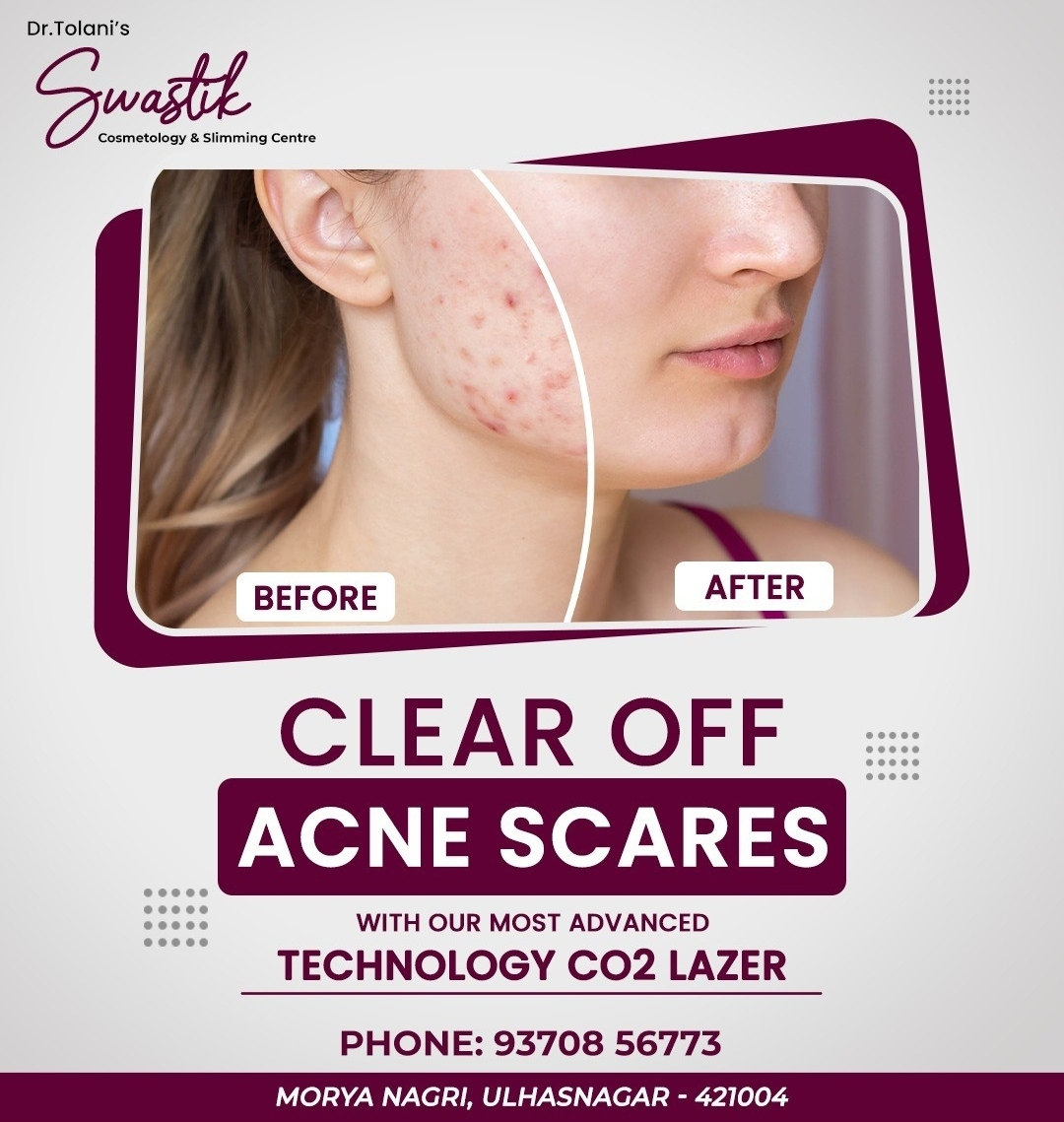 # CO2 Lazer Treatment in Ulhasnagar 
# Skin treatm... main image