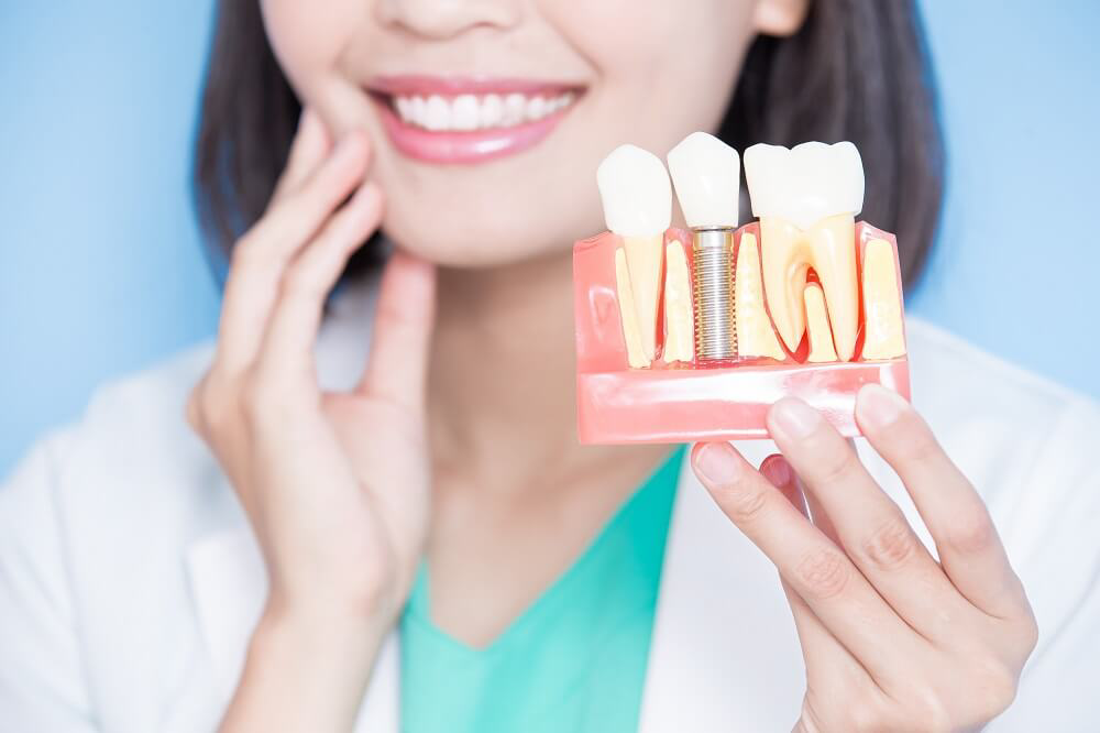 # Dental implants in Kalwa Thane
* Implant den... main image
