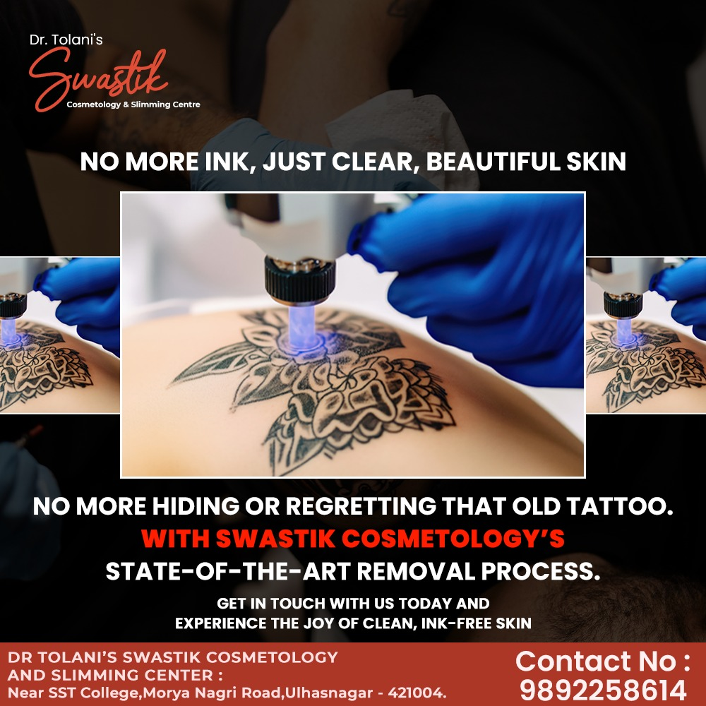 # Tattoo removal services in Ulhasnagar
# Best tat... main image