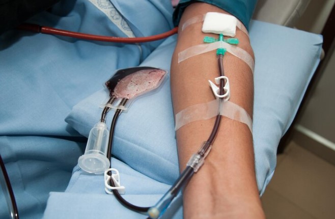 Dialysis Treatment i