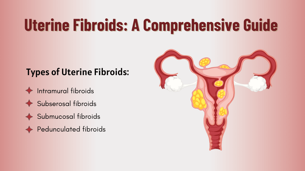 Fibroids are non-cancerous growths that develop... main image