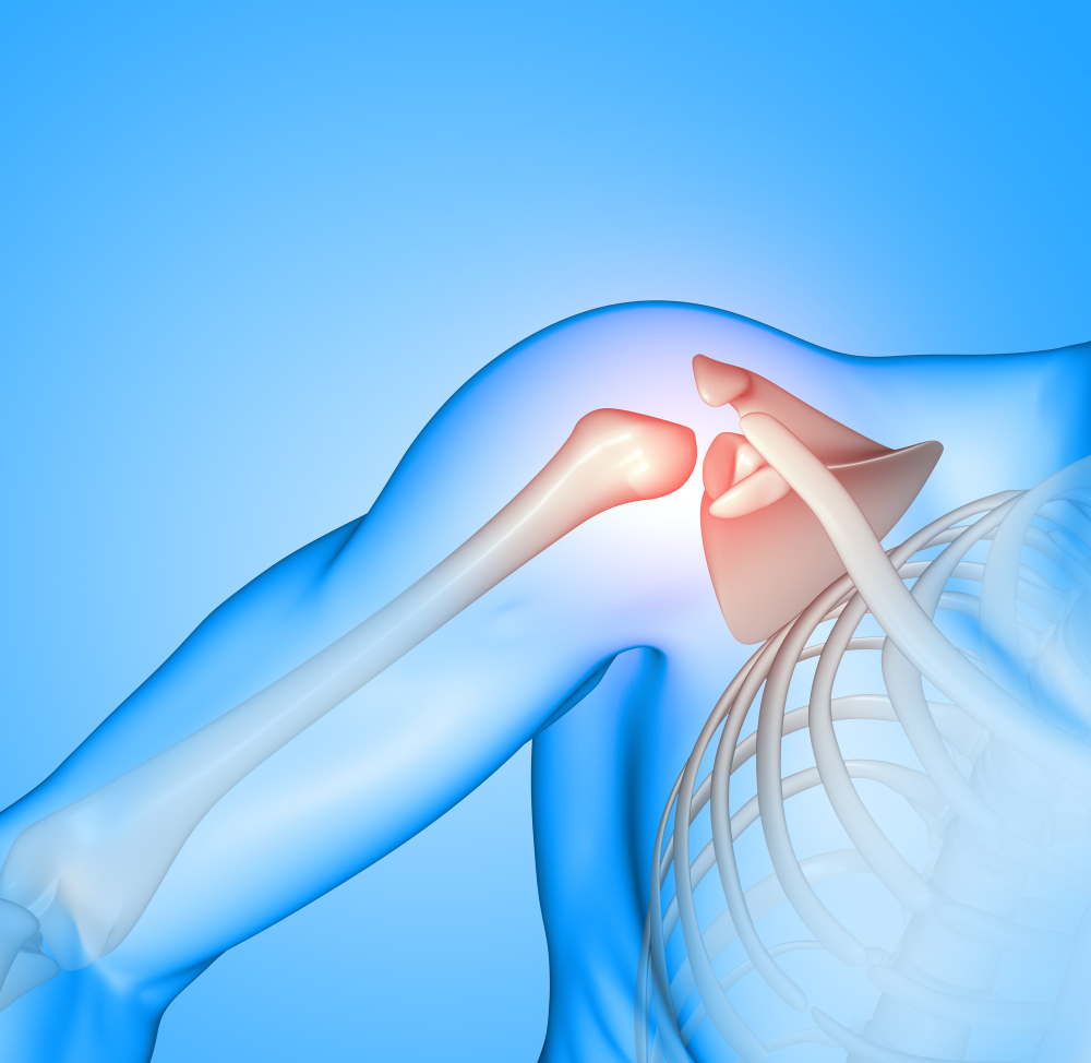 Shoulder Surgery Hospital in Pune: Regain Stren... main image
