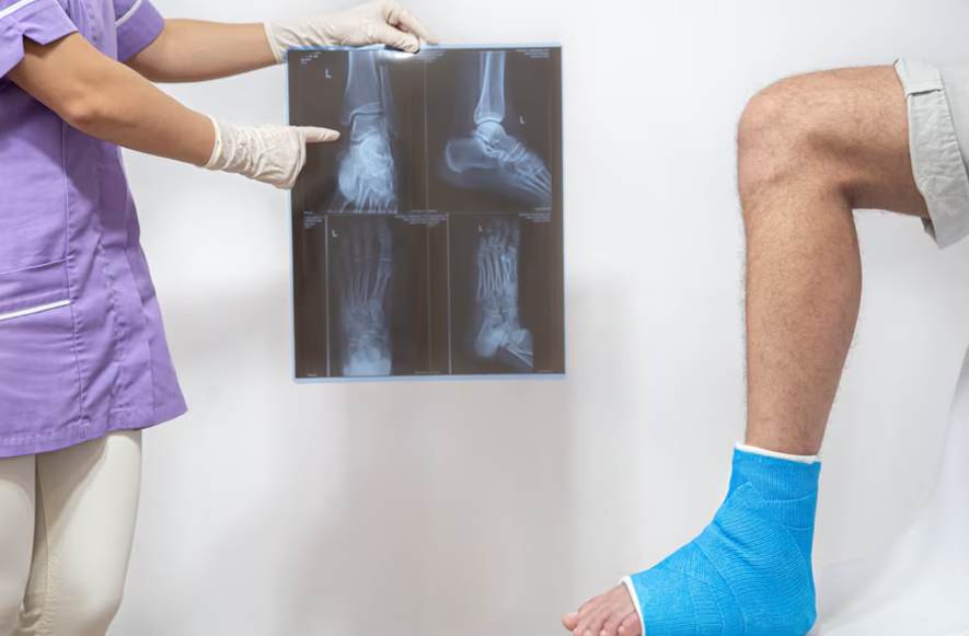 Best Bone Fracture Treatment in Chennai Bone fr... main image