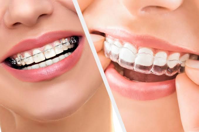 🌟 Only Braces Center - Best Orthodontist for In... main image