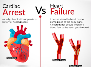 Cardiac Arrest vs. Heart Failure: 
Key Differen... main image