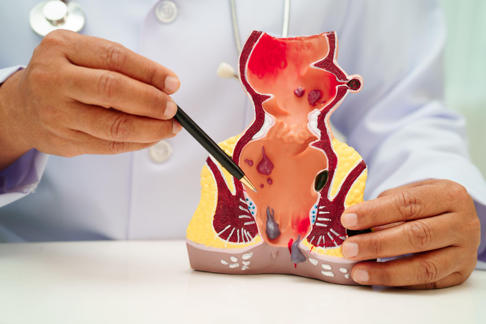 Proctologist in Velachery: Expert Care for Rect... main image