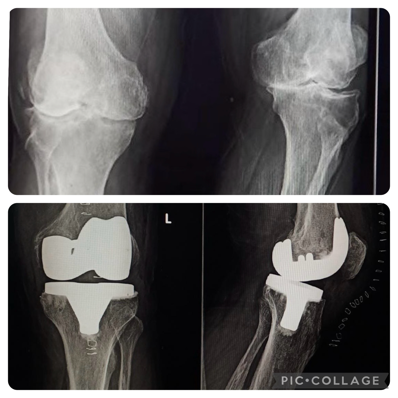 update image