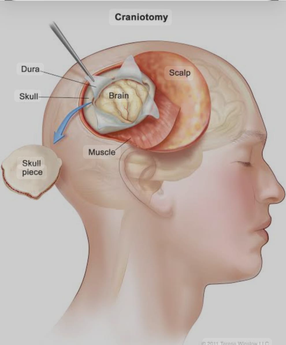 Comprehensive Neurosurgery Services
At Integrity H... main image