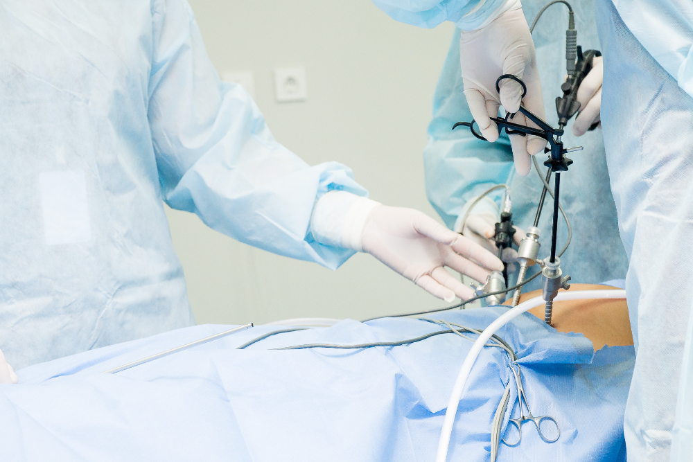 Laparoscopy Surgery Hospital in Pune: Precision... main image