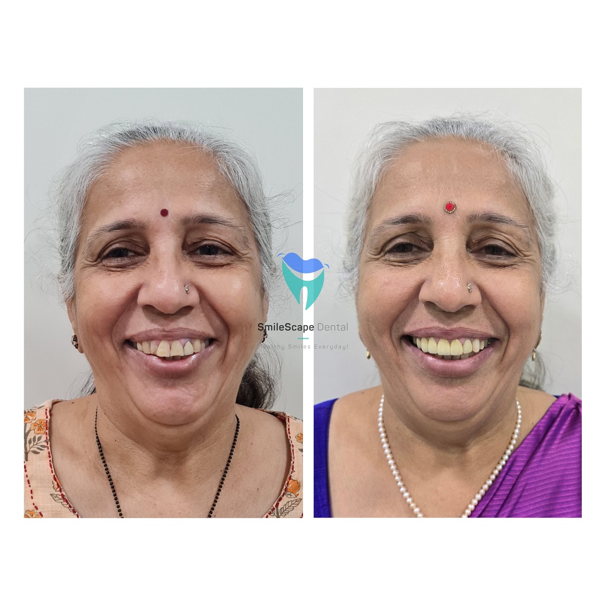 Every smile is unique and similarly, designing ... main image