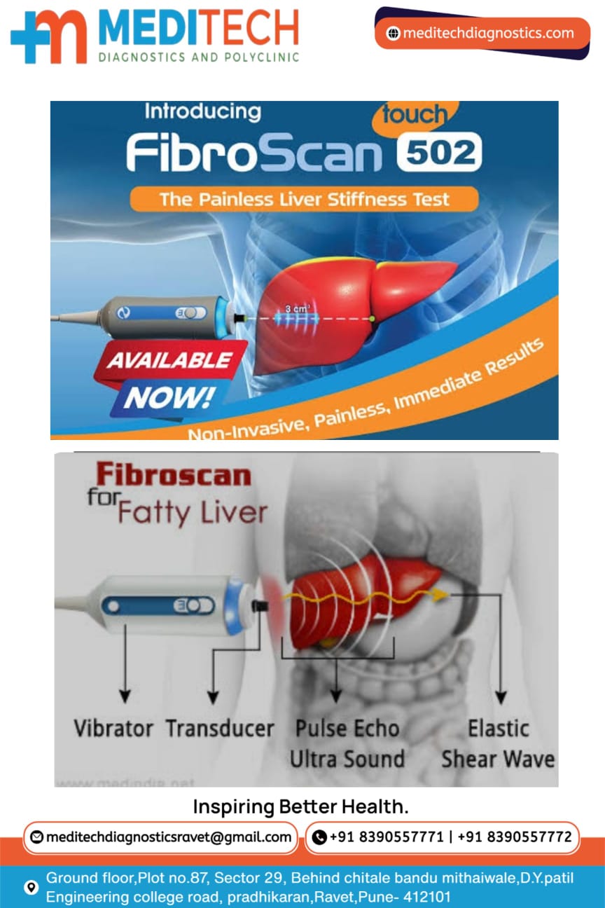 Fibroscan is a non-invasive ultrasound that measur... main image