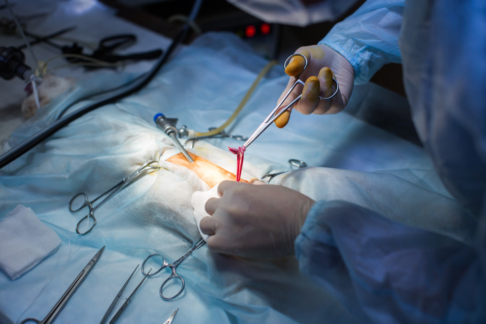 Comprehensive General Surgery Services in Mumba... main image