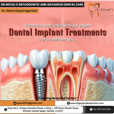 #BestDentalClinicinwakad
#BestRootCanalClinicin... main image