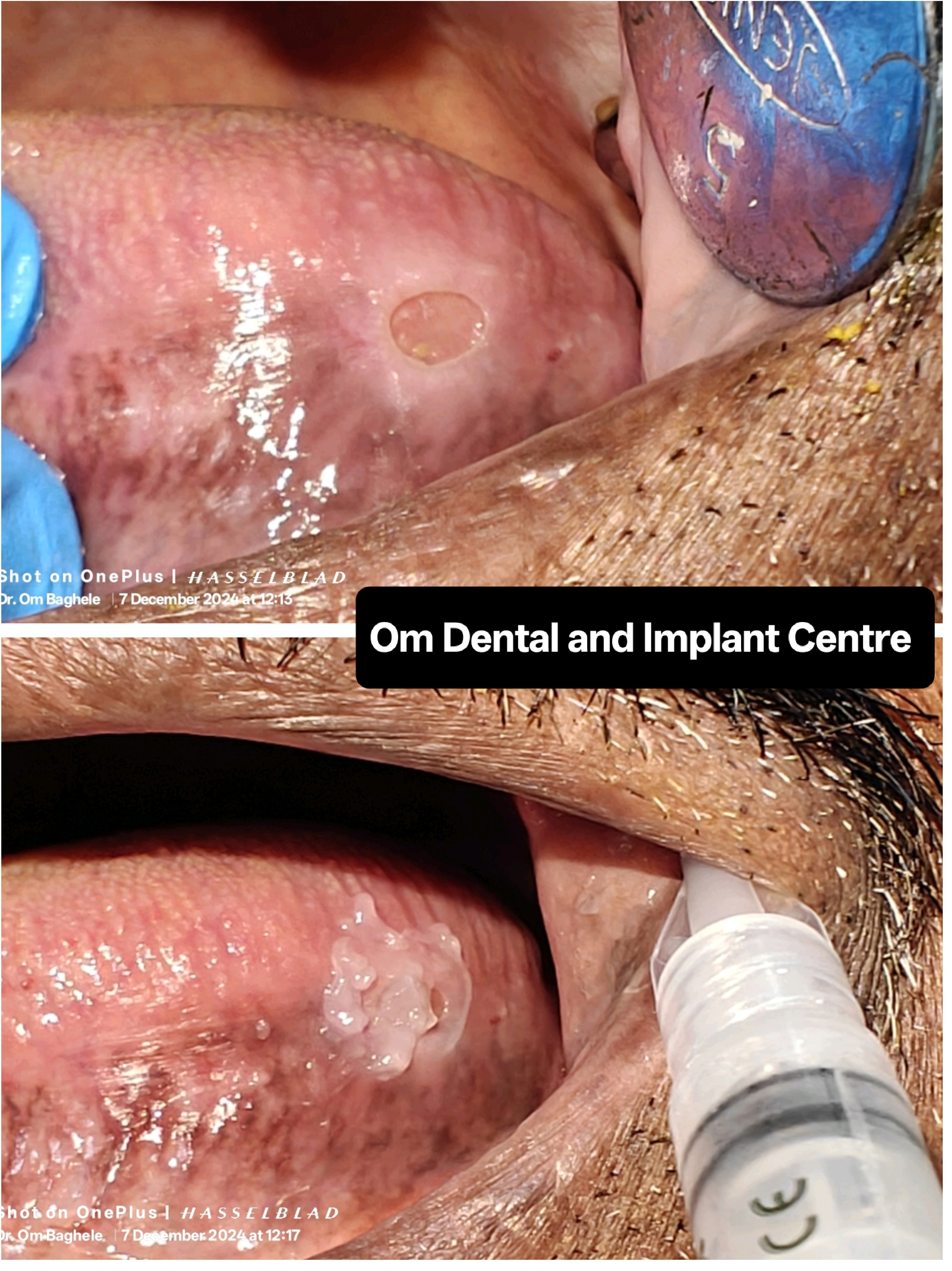Non-healing ulcers 
Many elderly patients may s... main image