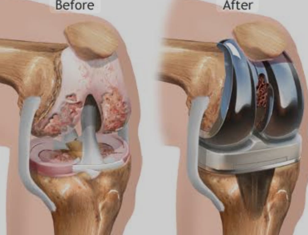 Advanced Joint Replacement Facility at Integrity H... main image