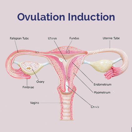 Ovulation Induction : 

Ovulation induction is ... main image