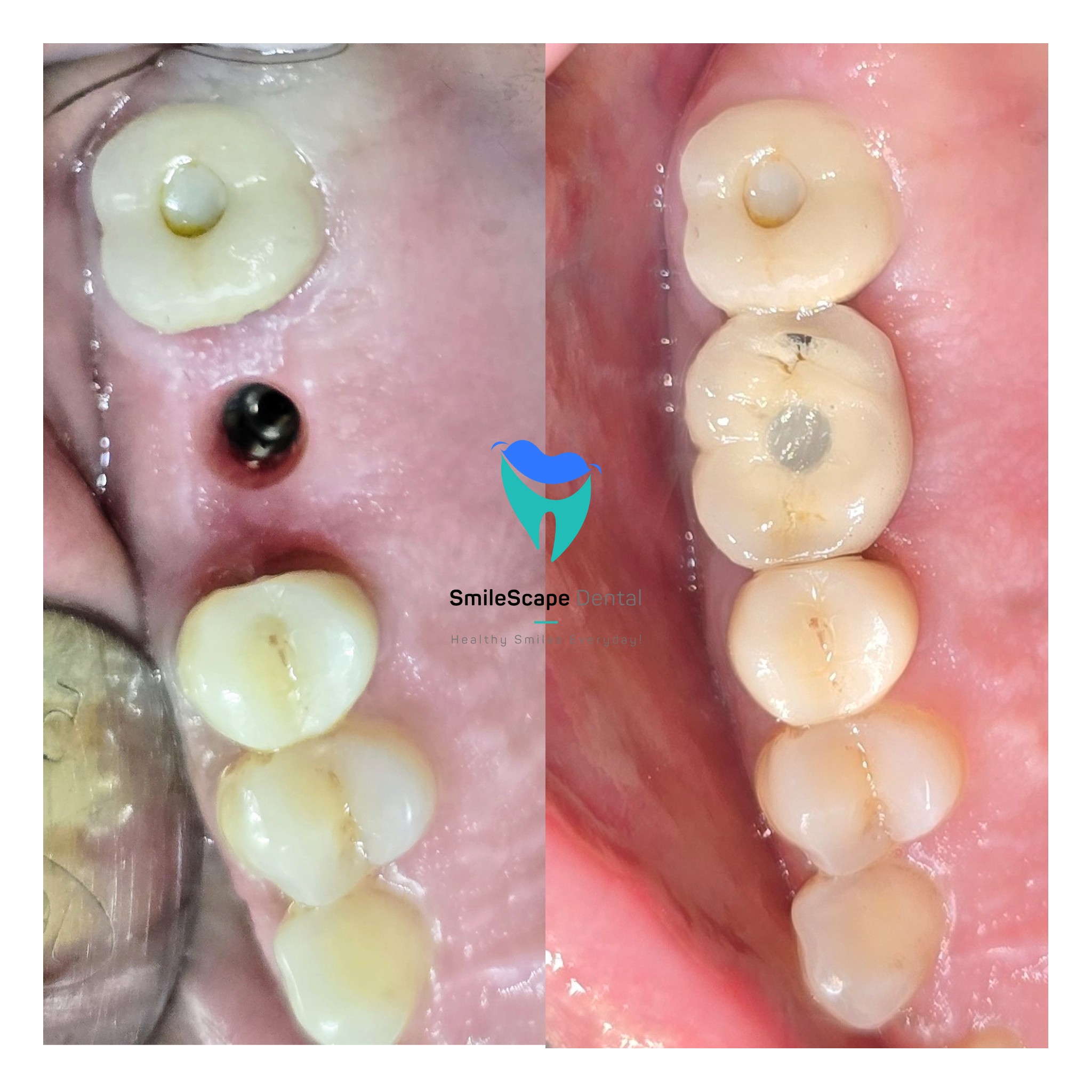 MISSING TEETH can create problems related to ch... main image