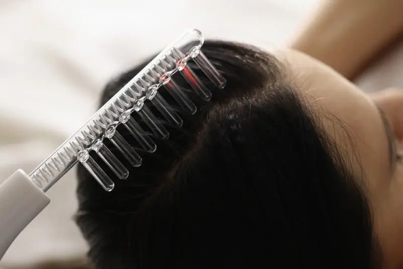 BEST DANDRUFF TREATMENT IN VADAPALANI @ELORA CL... main image