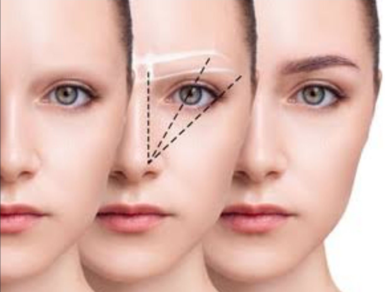 Eyebrow transplantation 
An eyebrow transplant ... main image