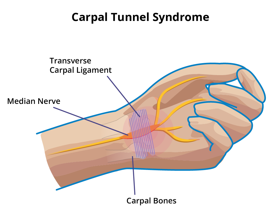 fingers treatment options