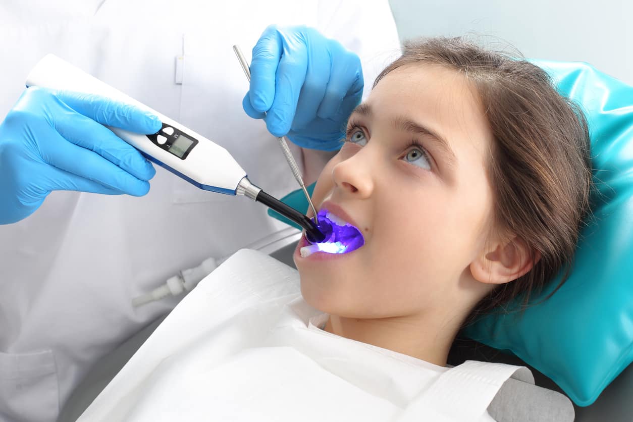 Laser Filling in South Delhi ﻿ Painless Laser F... main image
