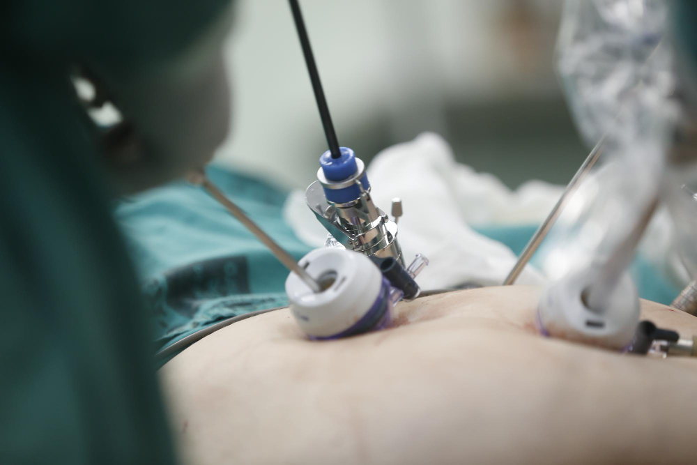 Gallbladder Lap Surgery in Mumbai Gallbladder l... main image