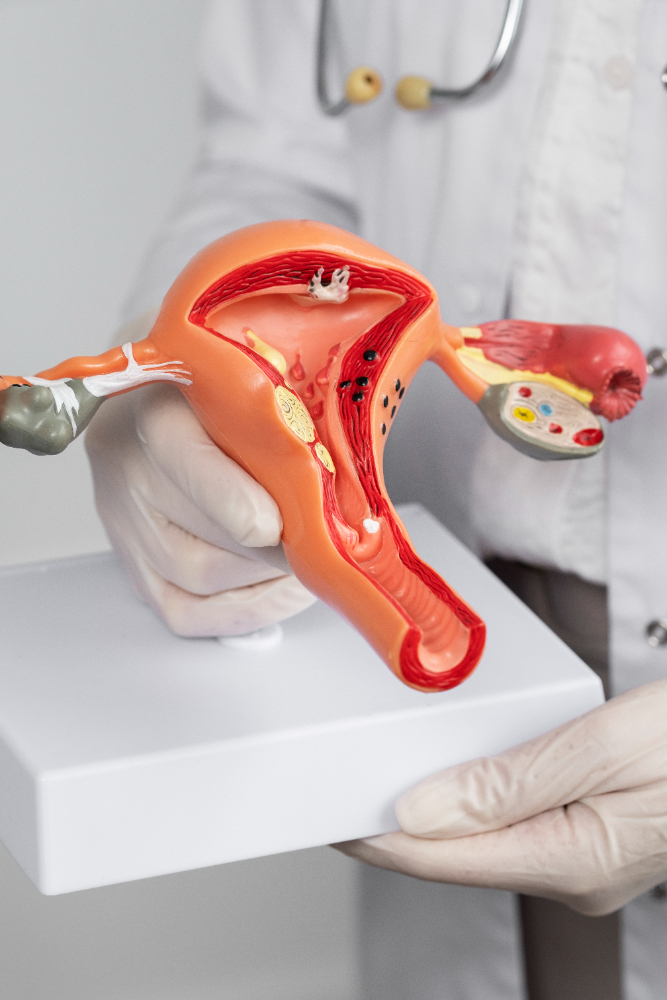 Oophorectomy Procedures in Chennai Oophorectomy... main image
