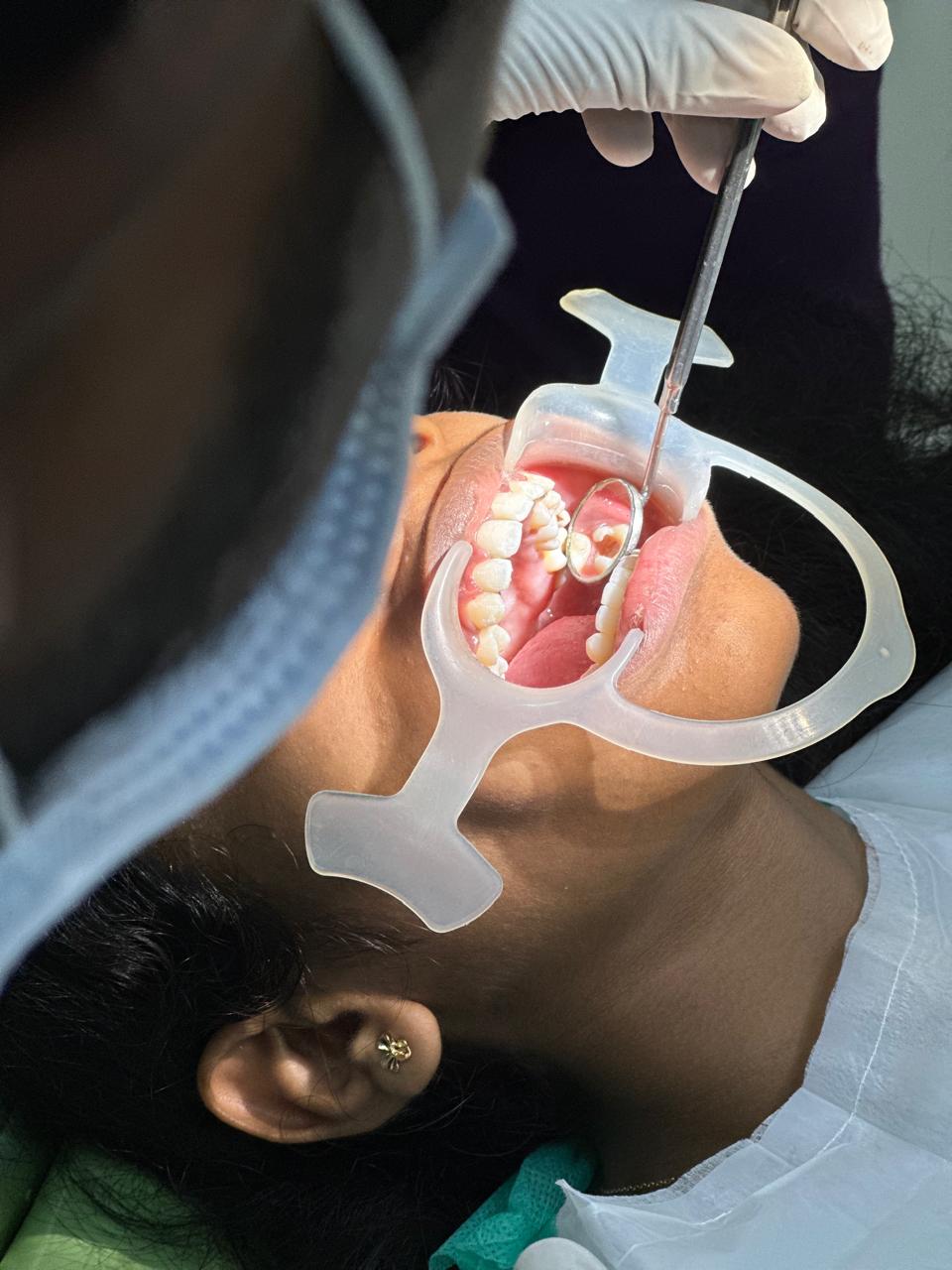 Affordable Root Canal Treatment in Manapakkam
R... main image