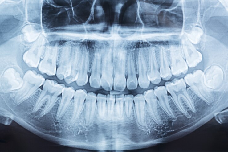 Dental Imaging (OPG)