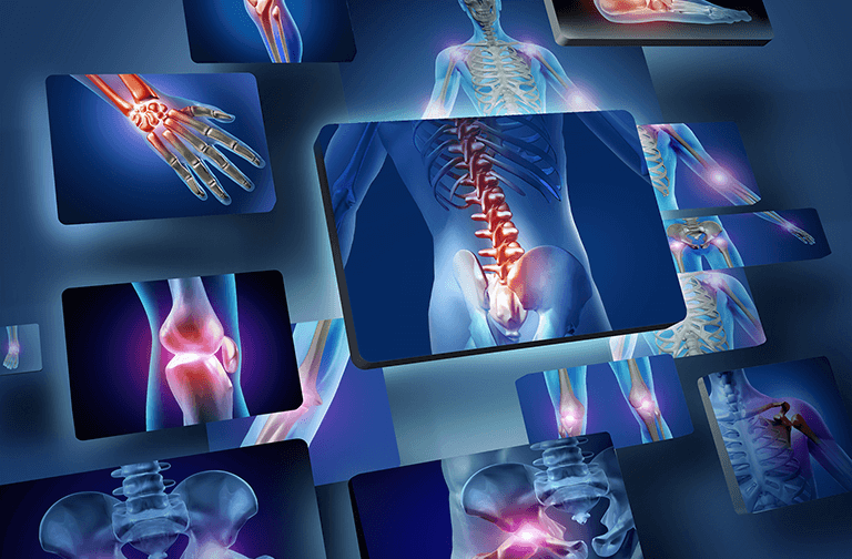 Orthopedic Hospital in Pune: Restoring Mobility... main image