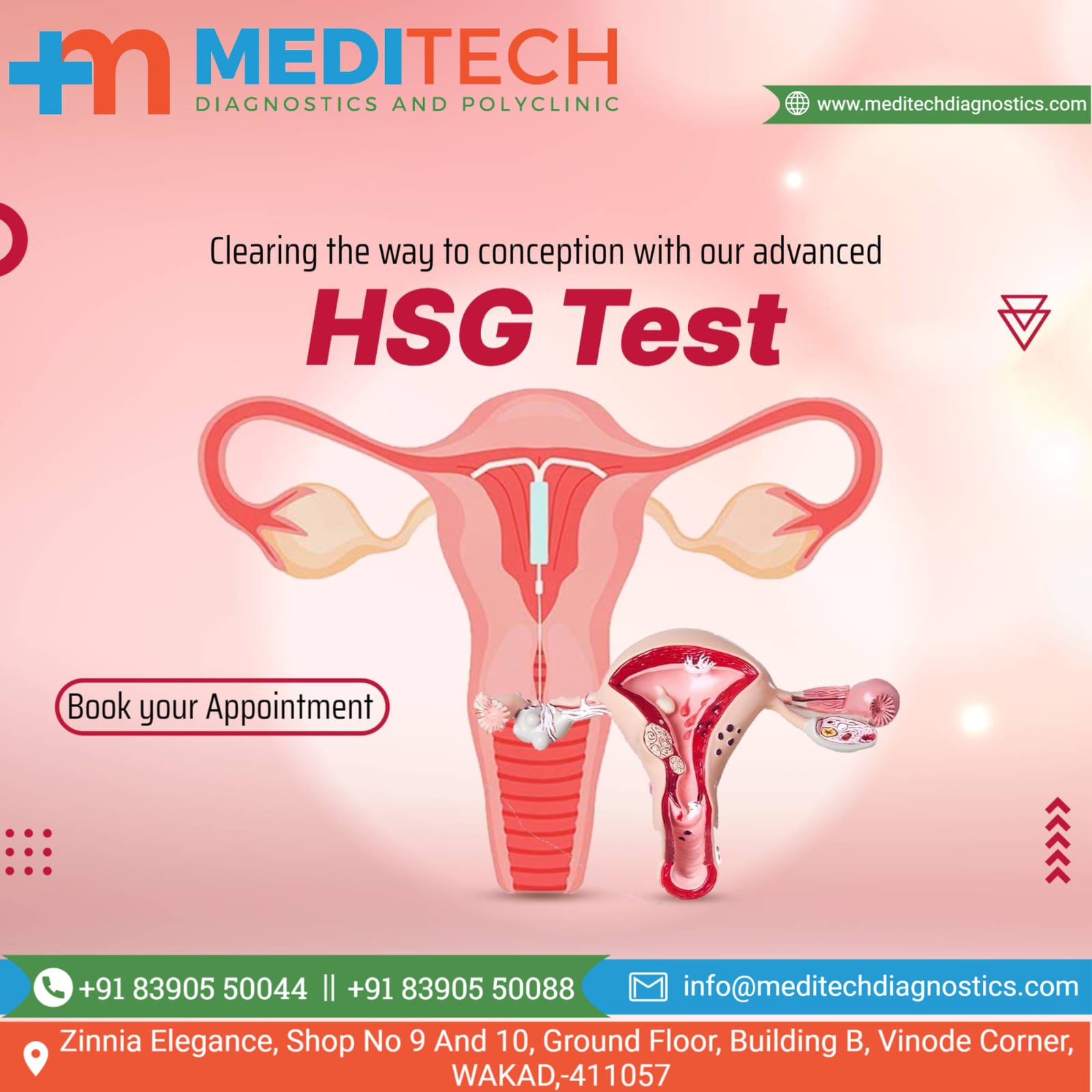 Hysterosalpingography (HSG), also known as uterosa... main image