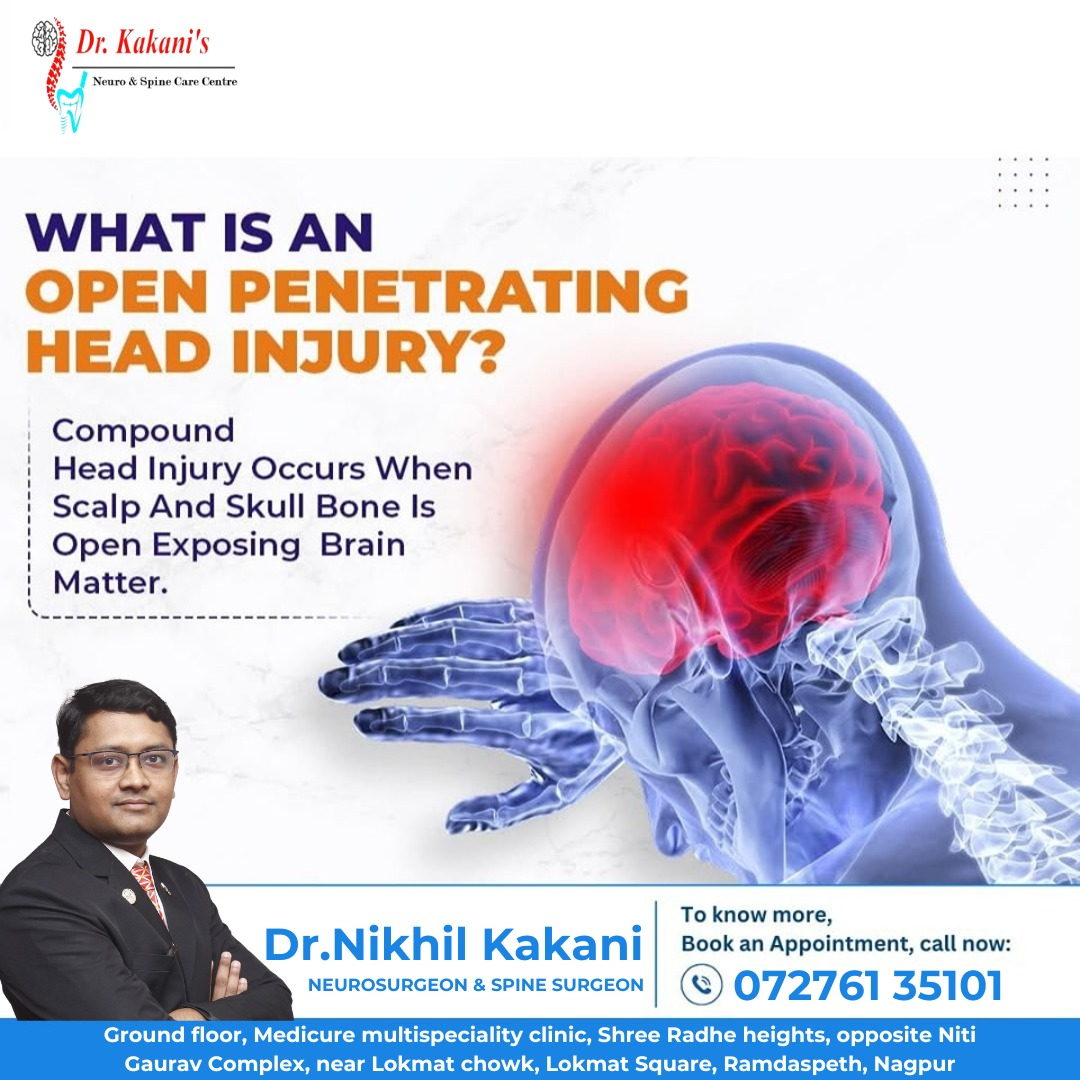 DON’T IGNORE CONSTANT HEADACHES

Frequent heada... main image