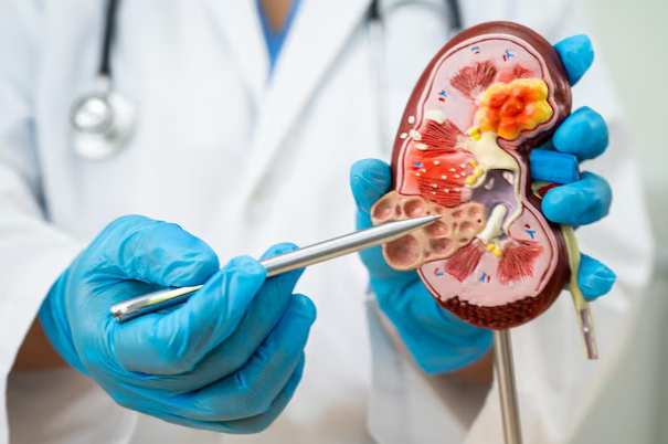 Trusted Urologist Care in Chennai for Kidney and B... main image