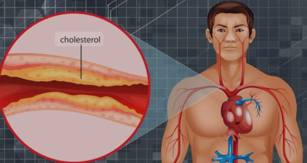 When it comes to heart health, timely and effec... main image