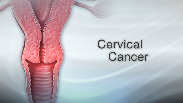 Diagnosing of pre-cancerous conditions involves... main image
