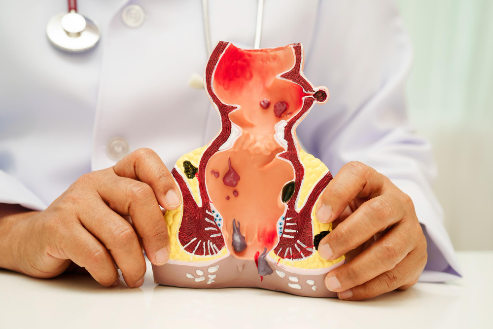 Proctologist in Velachery: Specialised Care for... main image