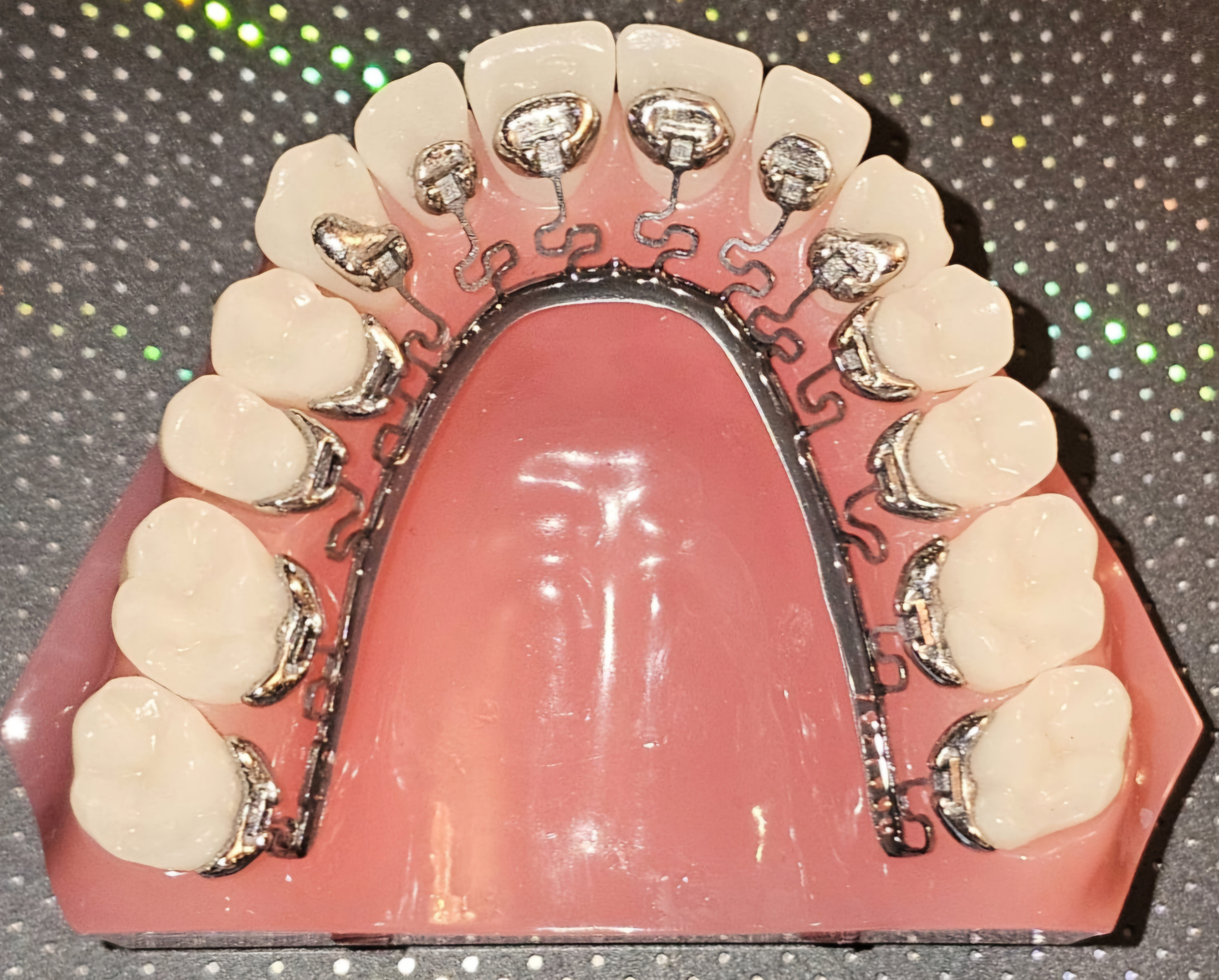 If you are looking for a fast treatment without... main image
