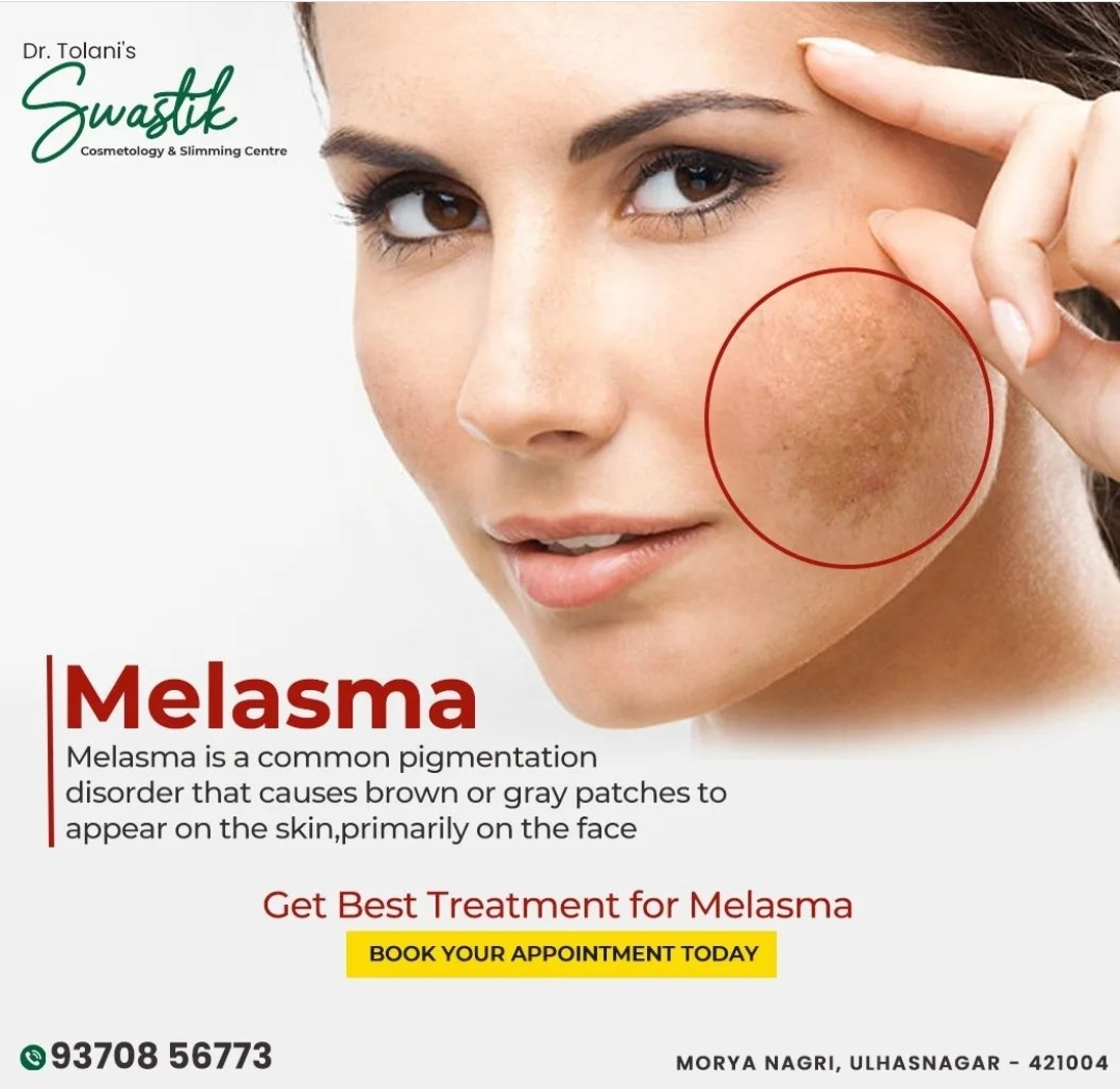 Looking for effective Melasma treatment? Swasti... main image