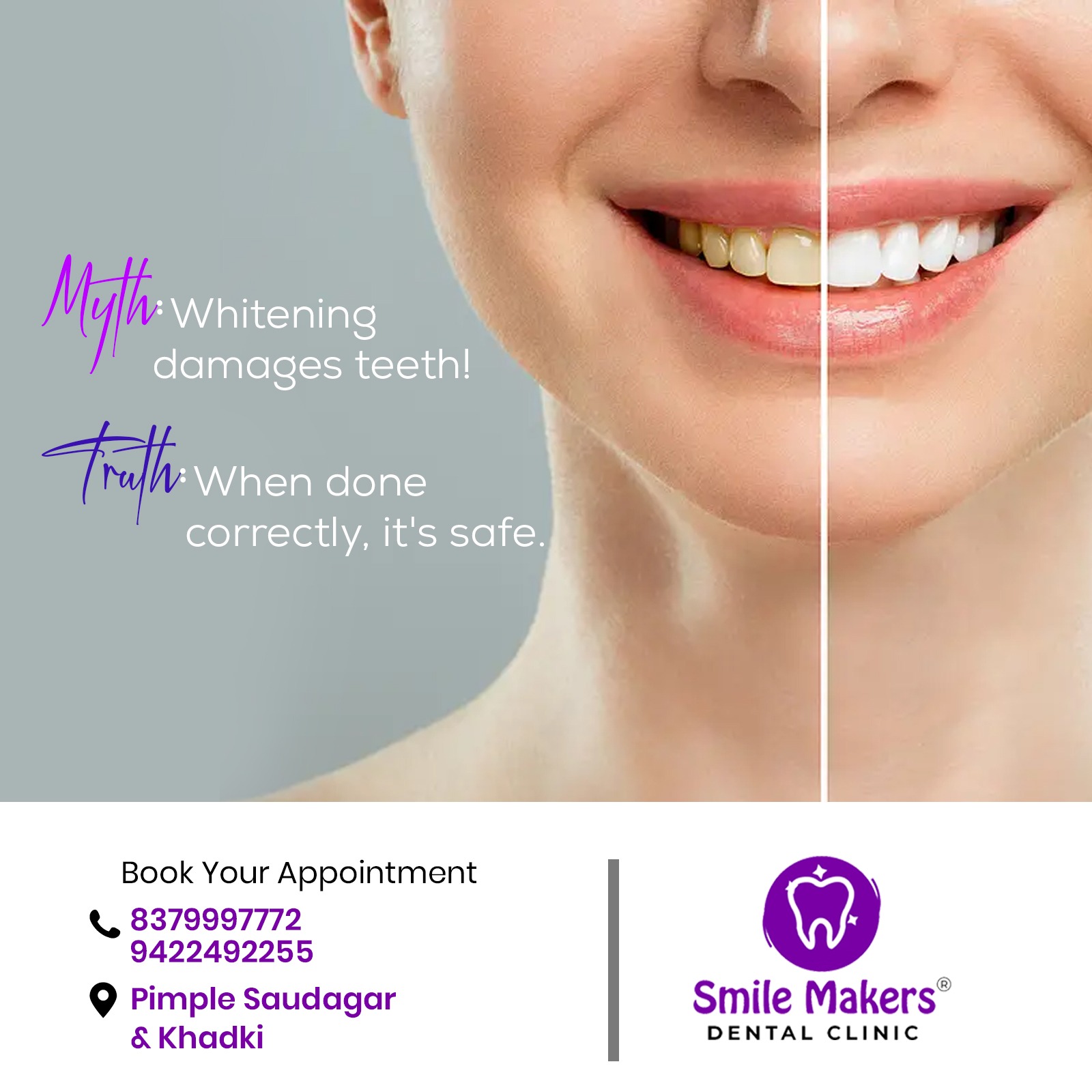 Best Teeth Whitening Clinic in Pimple Saudagar !

... main image