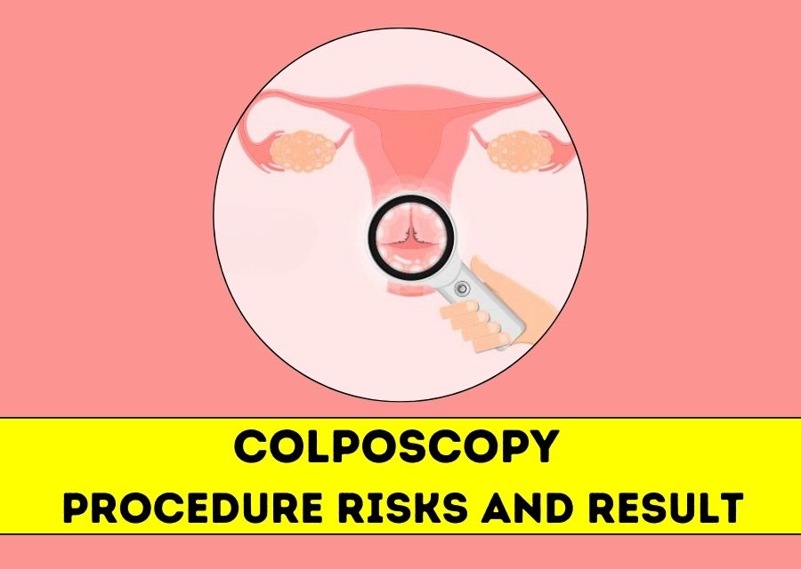 Colposcopy : 

What is Colposcopy?

Colposcopy ... main image