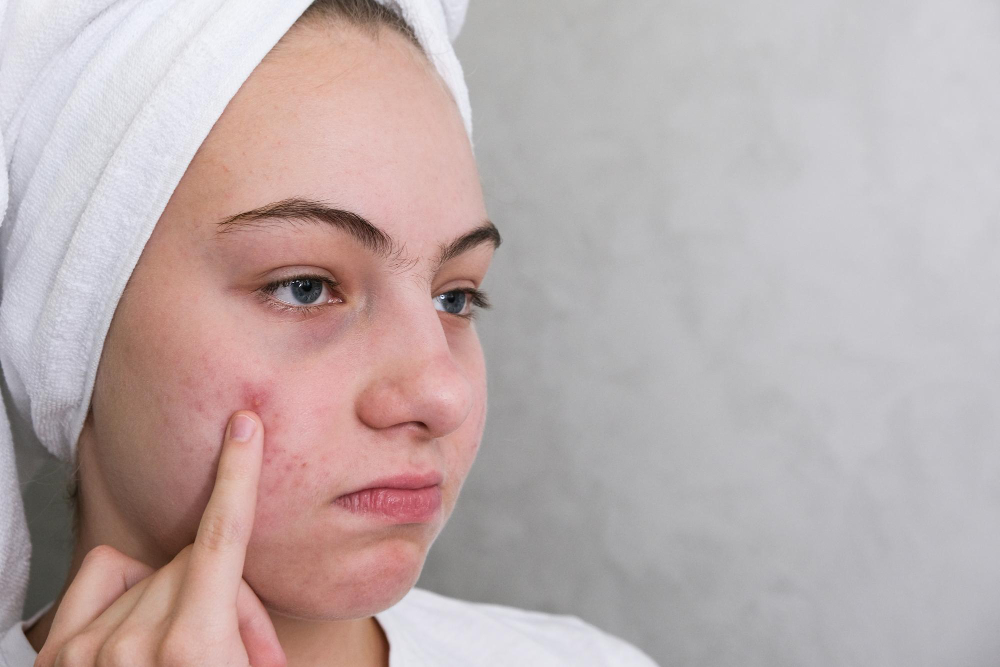 Skin Problems in Bishop Garden? Visit Finesse Aest... main image