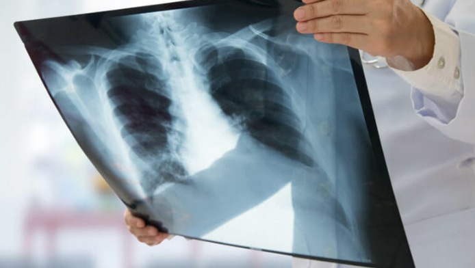 Digital X-Ray Servic
